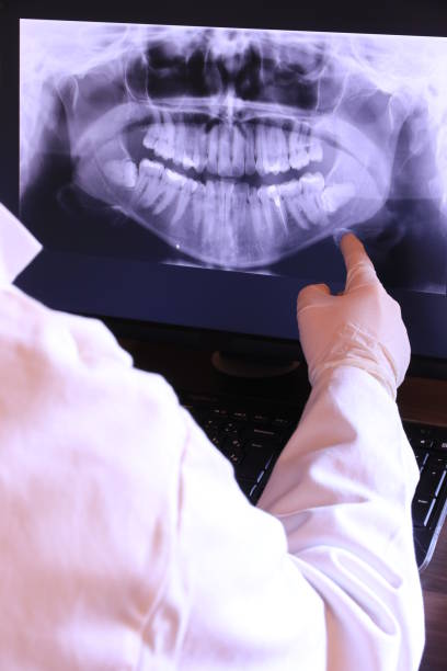 Best Emergency Wisdom Teeth Removal in Edwards, MS